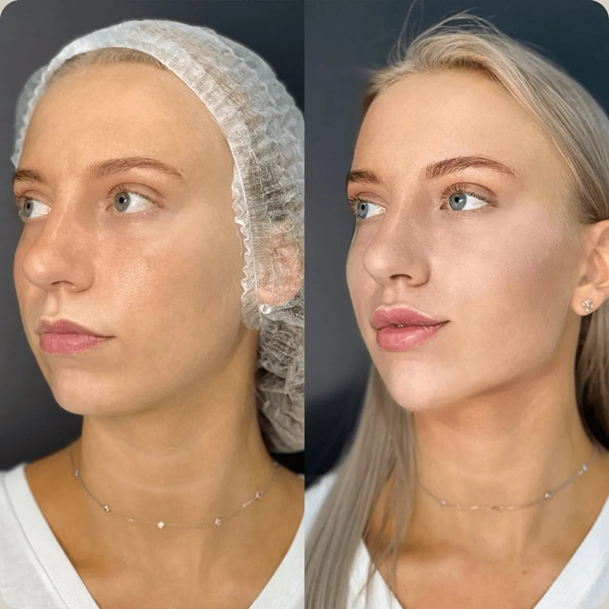 Before and after treatment, client 1