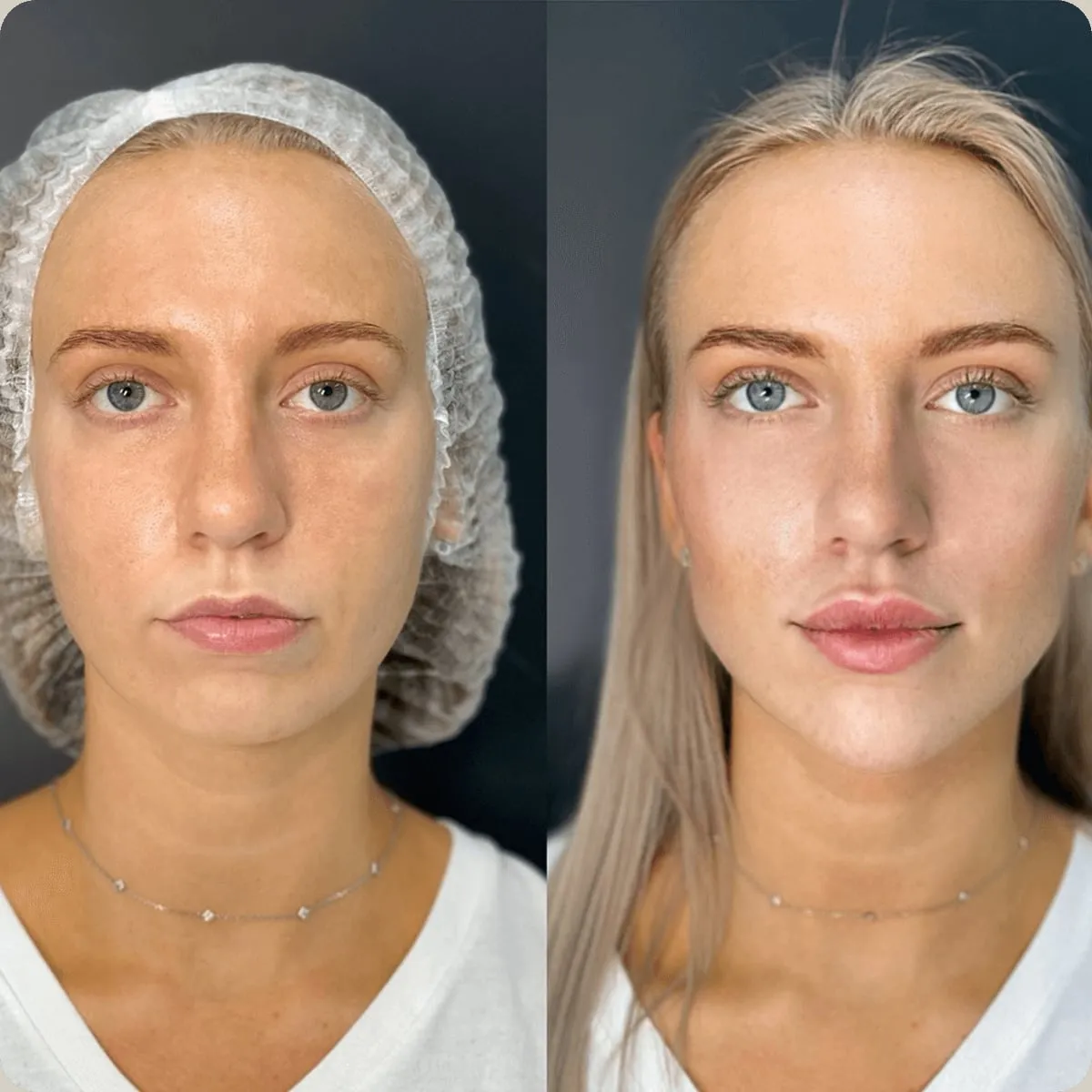 Before and after treatment, client 3