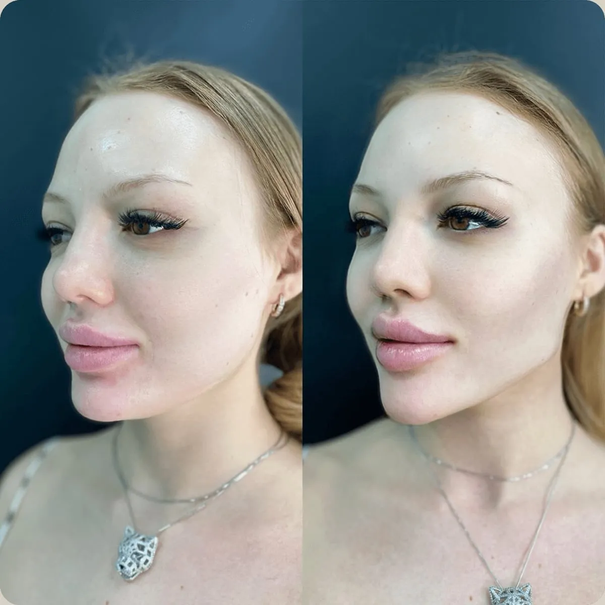 Before and after treatment, client 7