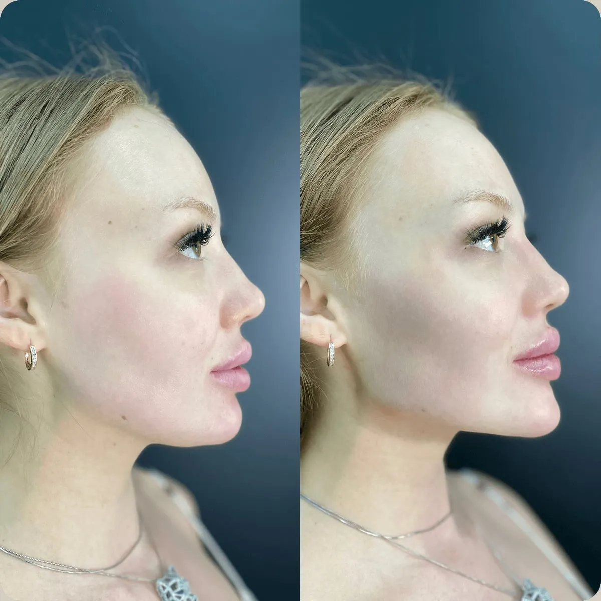 Before and after treatment, client 8