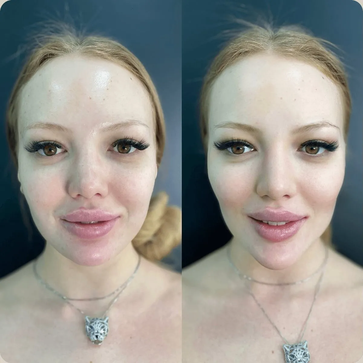 Before and after treatment, client 9