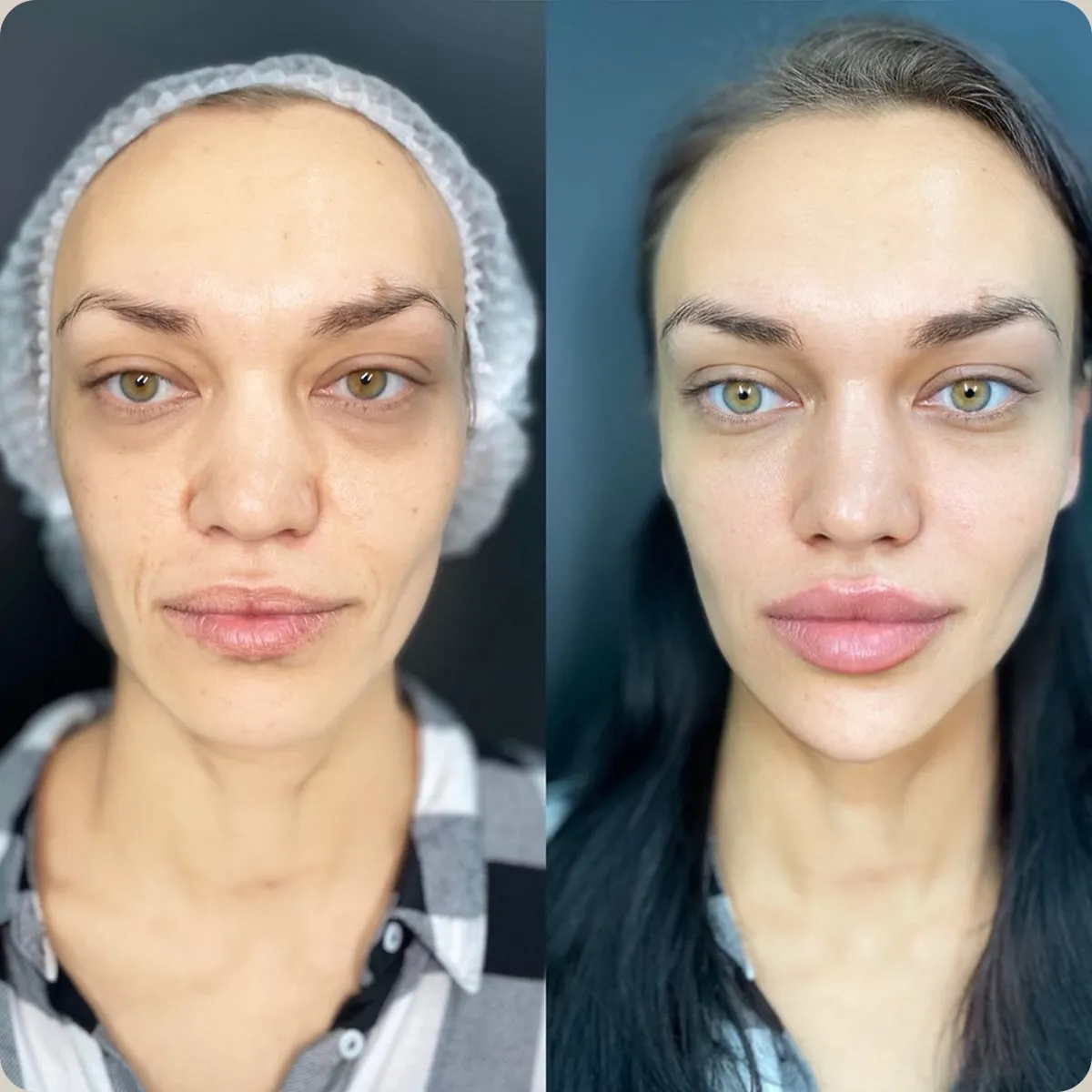 Before and after treatment, client 10