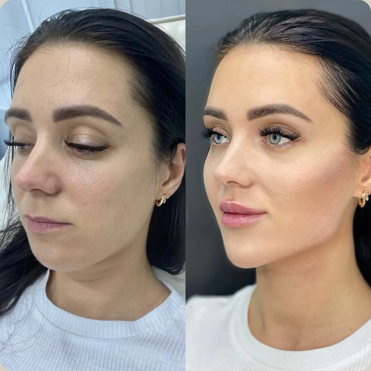 Before and after treatment, client 11