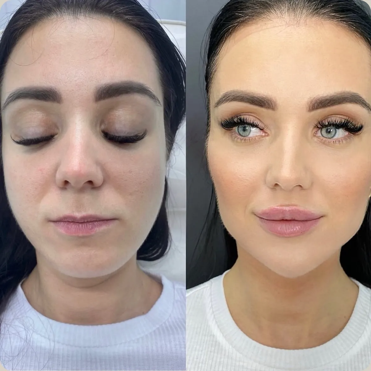 Before and after treatment, client 12