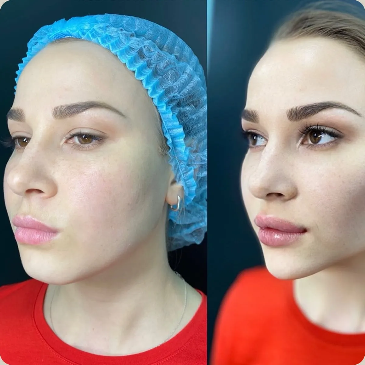 Before and after treatment, client 13